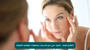 انتفاخ الوجه.. تعرف على أبرز الأسباب وخطوات الوقاية الفعالة